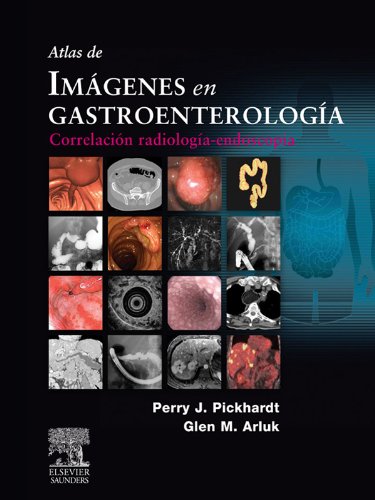 Atlas de imágenes en gastroenterología: Correlación radiología-endoscopia (Spanish Edition)