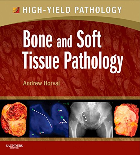 Bone and Soft Tissue Pathology: A Volume in the High Yield Pathology Series (English Edition)