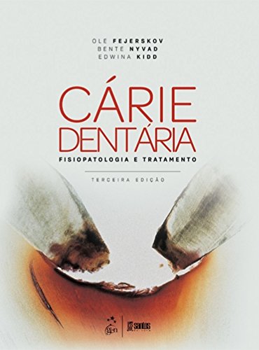 Cárie dentária: fisiopatologia e tratamento
