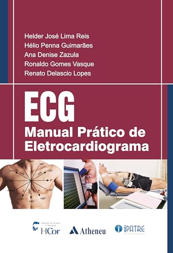 ECG
