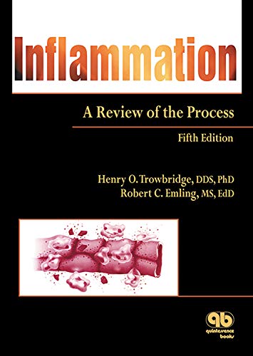 Inflammation: A Review of the Process (English Edition)