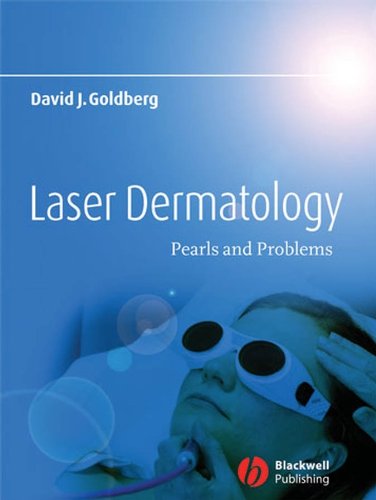 Laser Dermatology: Pearls and Problems (English Edition)