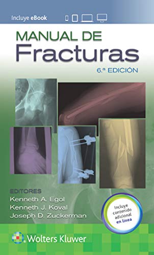 Manual de fracturas (Spanish Edition)