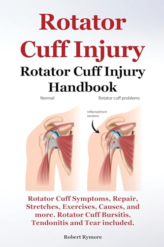 Rotator Cuff Injury. Rotator Cuff Injury Handbook. Rotator Cuff Symptoms, Repair, Stretches, Exercises, Causes and more. Rotator Cuff Bursitis, Tendonitis and Tear included. (English Edition)
