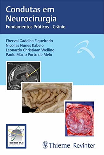 SBN Condutas em Neurocirurgia: Fundamentos Práticos