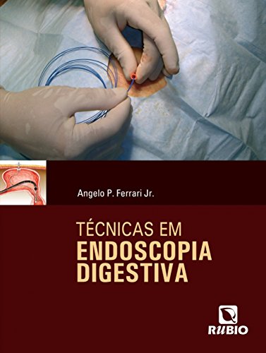Técnicas em Endoscopia Digestiva