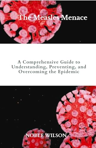 The Measles Menace: A Comprehensive Guide to Understanding, Preventing, and Overcoming the Epidemic (English Edition)